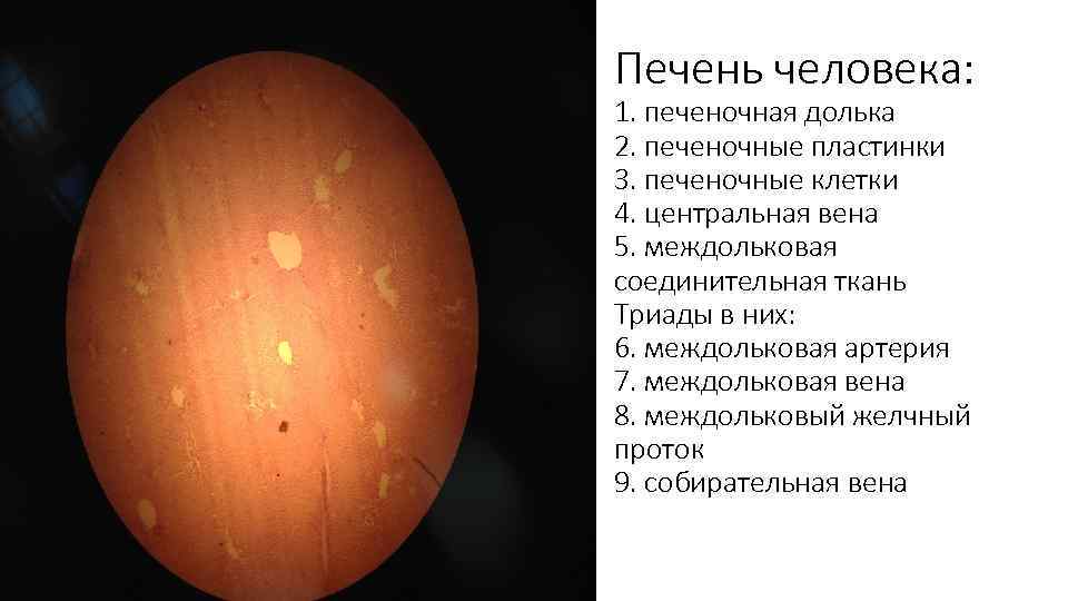 Печень человека: 1. печеночная долька 2. печеночные пластинки 3. печеночные клетки 4. центральная вена