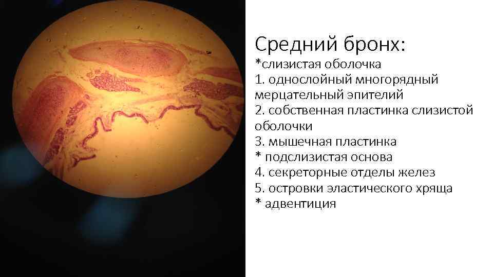 Средний бронх: *слизистая оболочка 1. однослойный многорядный мерцательный эпителий 2. собственная пластинка слизистой оболочки