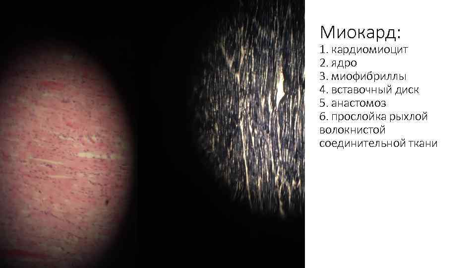 Миокард: 1. кардиомиоцит 2. ядро 3. миофибриллы 4. вставочный диск 5. анастомоз 6. прослойка