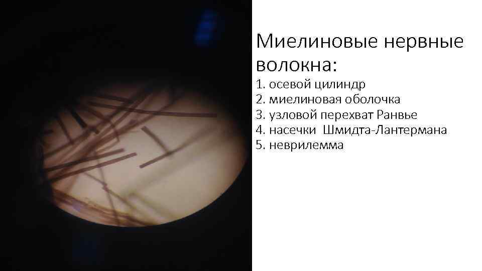 Миелиновые нервные волокна: 1. осевой цилиндр 2. миелиновая оболочка 3. узловой перехват Ранвье 4.