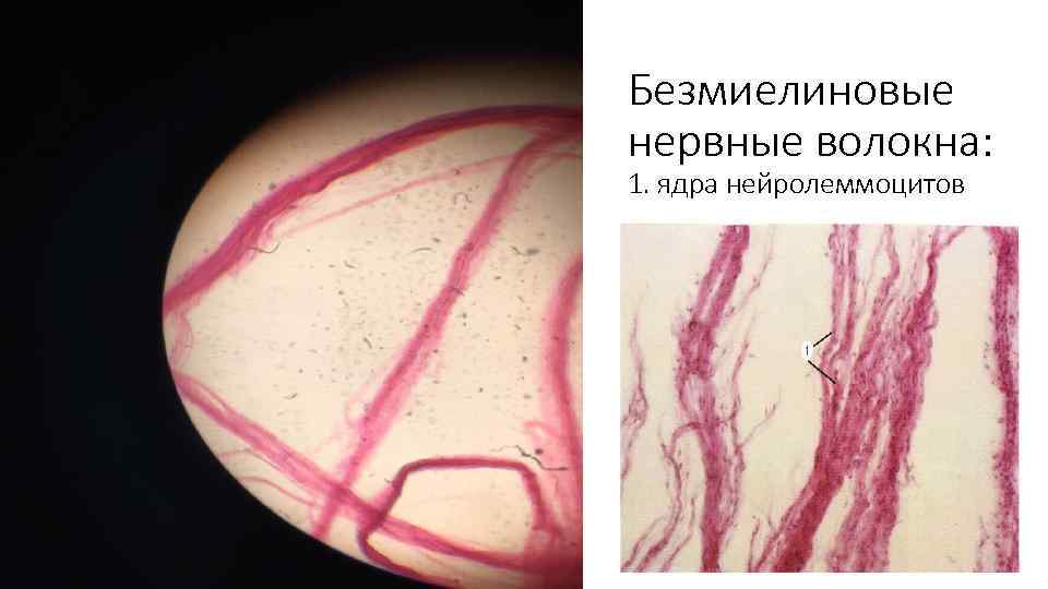 Безмиелиновые нервные волокна: 1. ядра нейролеммоцитов 