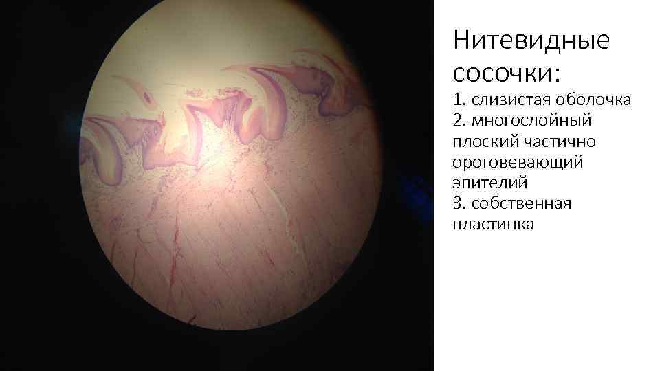 Нитевидные сосочки: 1. слизистая оболочка 2. многослойный плоский частично ороговевающий эпителий 3. собственная пластинка