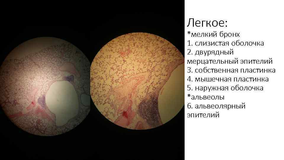 Легкое: *мелкий бронх 1. слизистая оболочка 2. двурядный мерцательный эпителий 3. собственная пластинка 4.