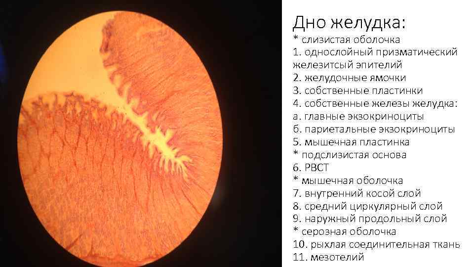 Дно желудка: * слизистая оболочка 1. однослойный призматический железитсый эпителий 2. желудочные ямочки 3.