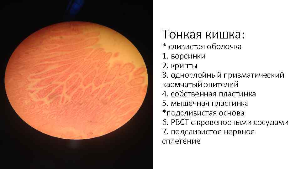 Тонкая кишка: * слизистая оболочка 1. ворсинки 2. крипты 3. однослойный призматический каемчатый эпителий