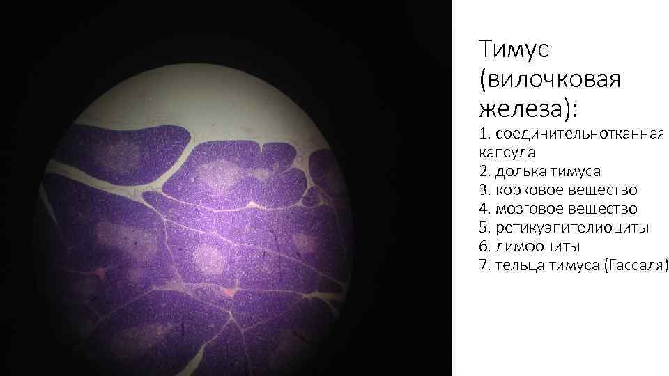 Тимус (вилочковая железа): 1. соединительнотканная капсула 2. долька тимуса 3. корковое вещество 4. мозговое
