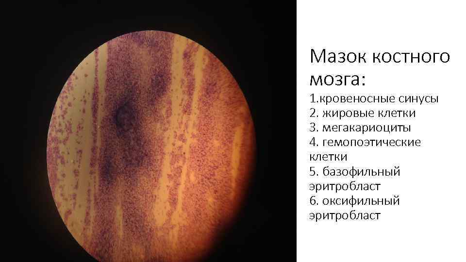Мазок костного мозга: 1. кровеносные синусы 2. жировые клетки 3. мегакариоциты 4. гемопоэтические клетки
