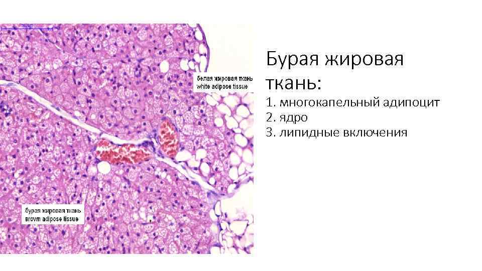 Бурая жировая ткань: 1. многокапельный адипоцит 2. ядро 3. липидные включения 