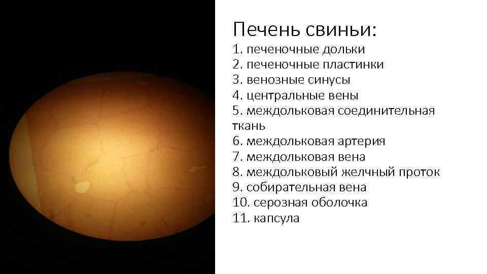 Печень свиньи: 1. печеночные дольки 2. печеночные пластинки 3. венозные синусы 4. центральные вены