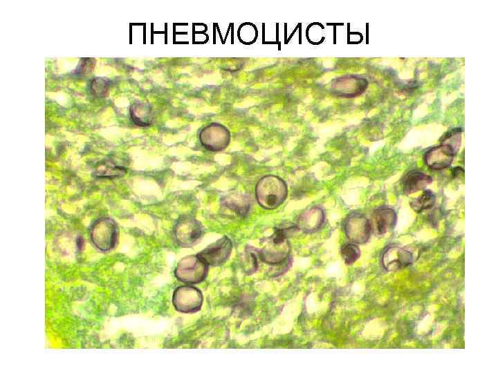 ПНЕВМОЦИСТЫ 