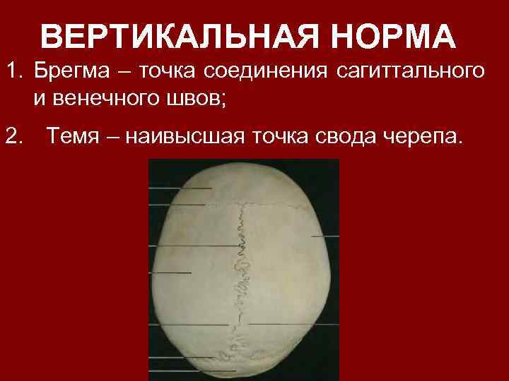 Норма вертикали