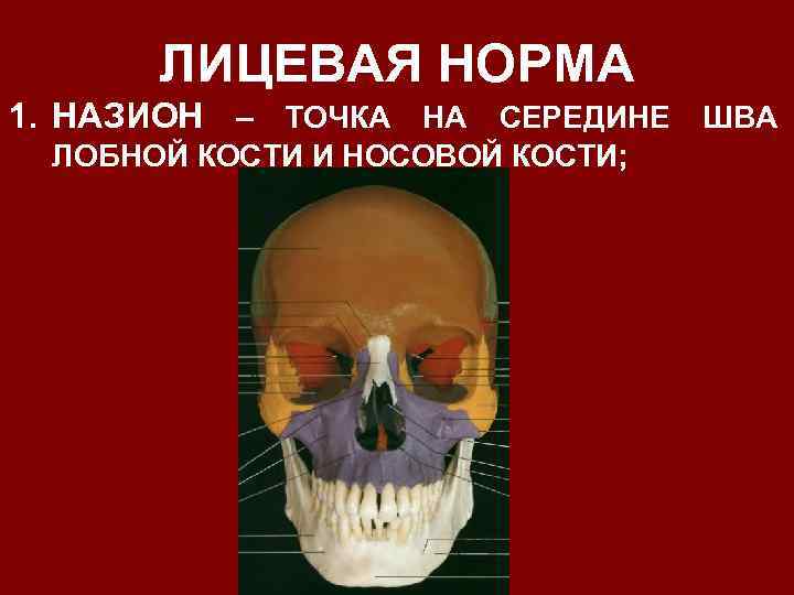 ЛИЦЕВАЯ НОРМА 1. НАЗИОН – ТОЧКА НА СЕРЕДИНЕ ШВА ЛОБНОЙ КОСТИ И НОСОВОЙ КОСТИ;