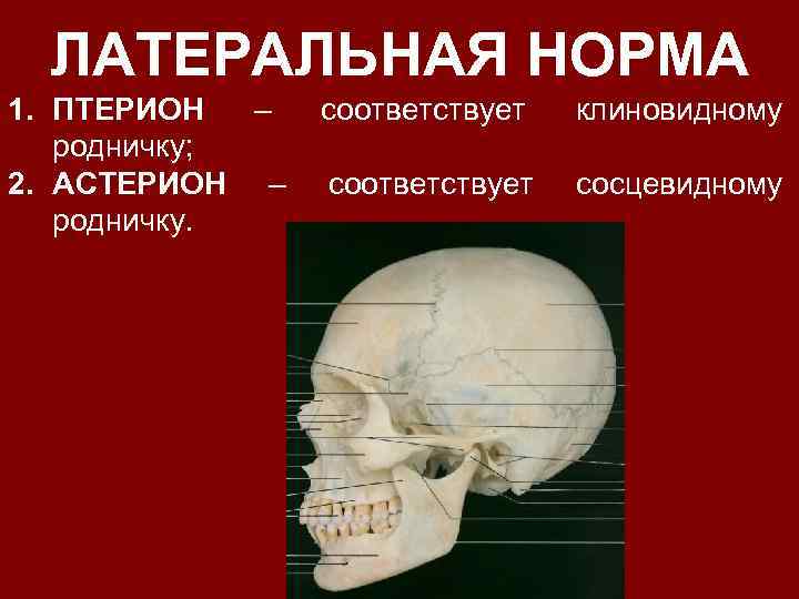 ЛАТЕРАЛЬНАЯ НОРМА 1. ПТЕРИОН – родничку; 2. АСТЕРИОН – родничку. соответствует клиновидному соответствует сосцевидному