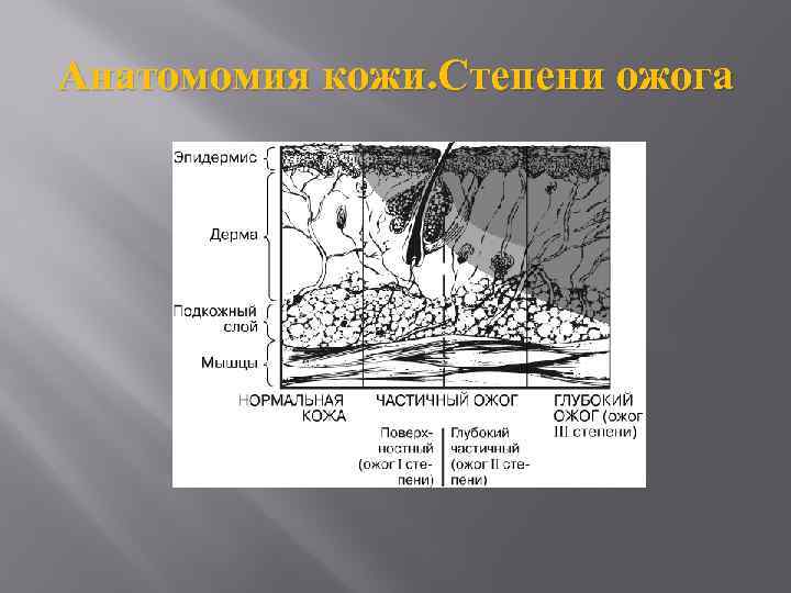 Анатомомия кожи. Степени ожога 