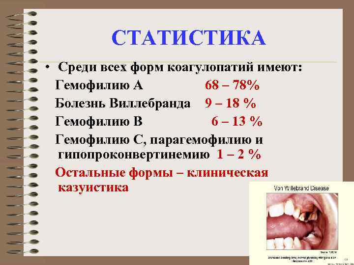 СТАТИСТИКА • Среди всех форм коагулопатий имеют: Гемофилию А 68 – 78% Болезнь Виллебранда