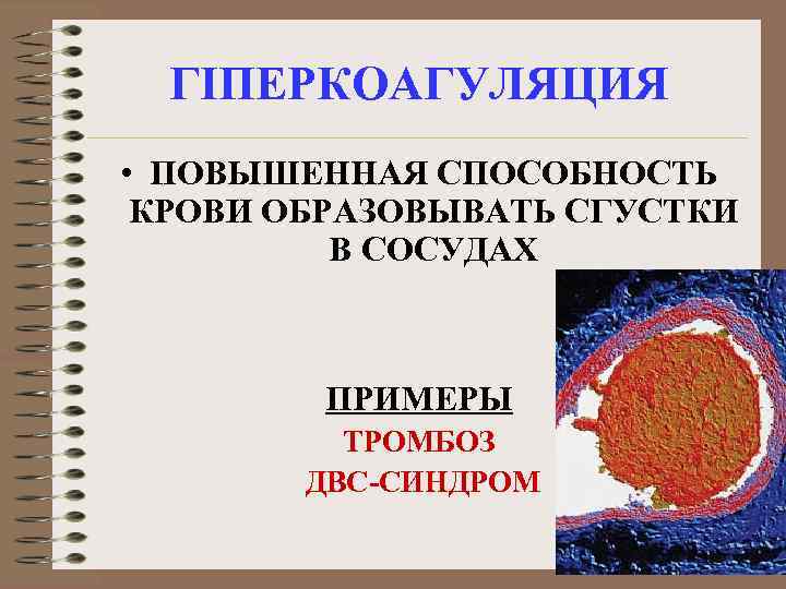 ГІПЕРКОАГУЛЯЦИЯ • ПОВЫШЕННАЯ СПОСОБНОСТЬ КРОВИ ОБРАЗОВЫВАТЬ СГУСТКИ В СОСУДАХ ПРИМЕРЫ ТРОМБОЗ ДВС-СИНДРОМ 