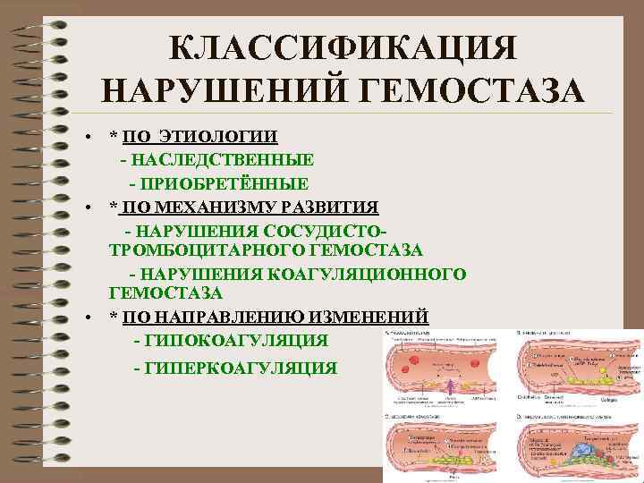 КЛАССИФИКАЦИЯ НАРУШЕНИЙ ГЕМОСТАЗА • * ПО ЭТИОЛОГИИ - НАСЛЕДСТВЕННЫЕ - ПРИОБРЕТЁННЫЕ • * ПО