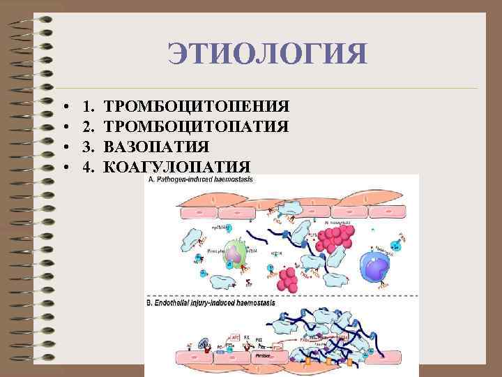 ЭТИОЛОГИЯ • • 1. ТРОМБОЦИТОПЕНИЯ 2. ТРОМБОЦИТОПАТИЯ 3. ВАЗОПАТИЯ 4. КОАГУЛОПАТИЯ 