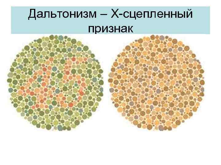 Дальтонизм – Х-сцепленный признак 