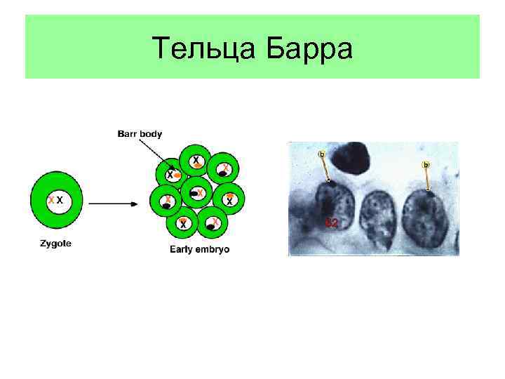 Рисунок тельца барра