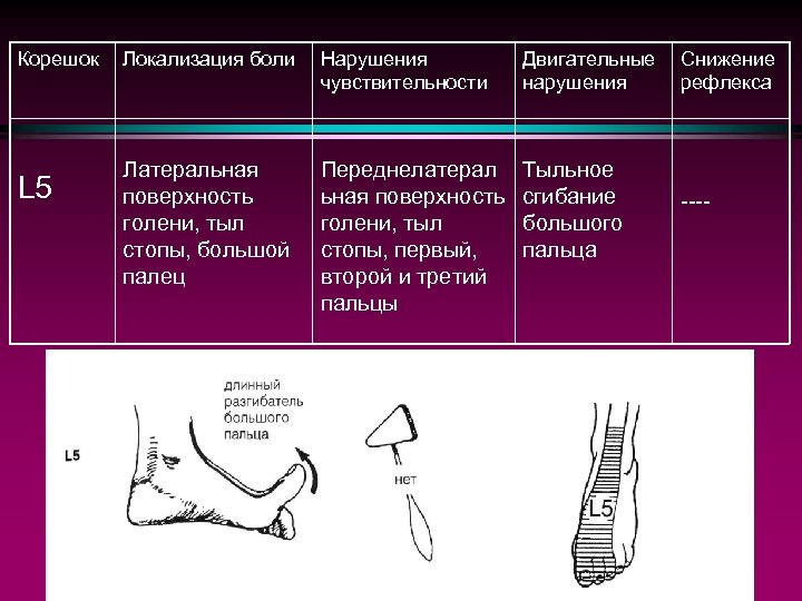 Поверхность нарушения