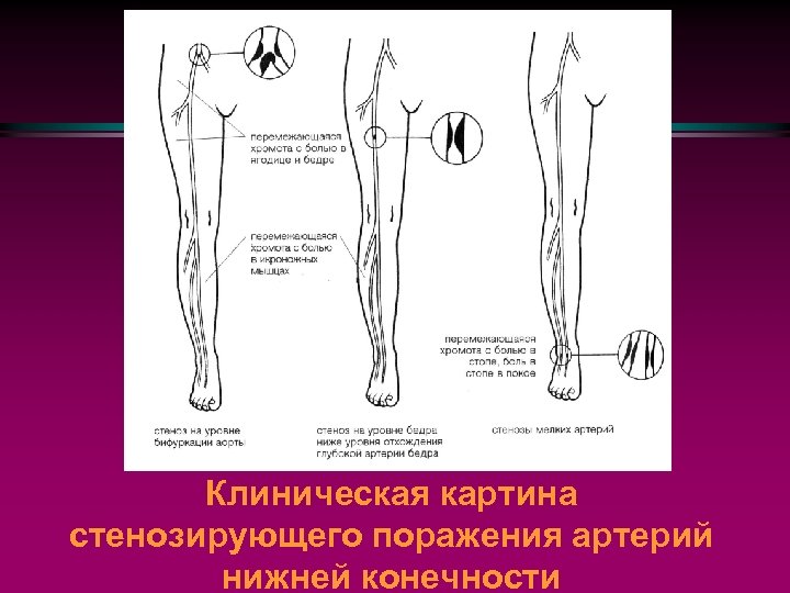 Сильный пульс в ногах. Пульсация артерий нижних конечностей схема. Измерение пульса на артериях нижних конечностей. Точки определения пульсации на артериях нижних конечностей. Точки пульсации артерий на нижних конечностях.
