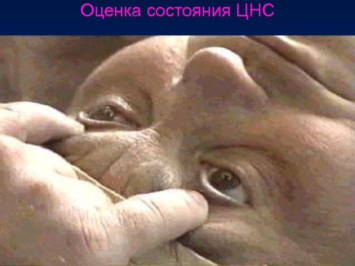 Оценка состояния ЦНС 