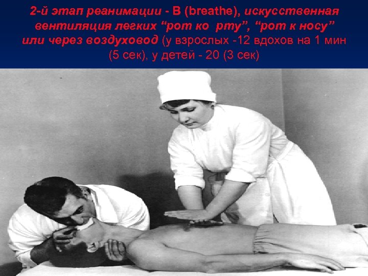 2 -й этап реанимации - В (breathe), искусственная вентиляция легких “рот ко рту”, “рот