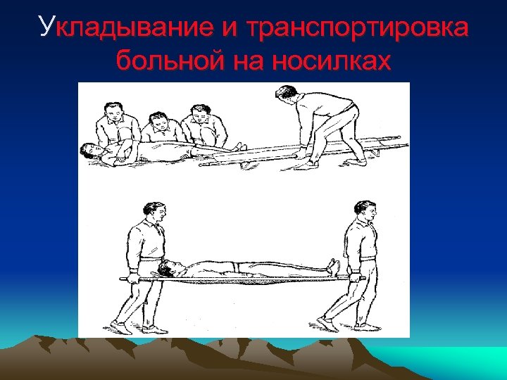 Укладывание и транспортировка больной на носилках 