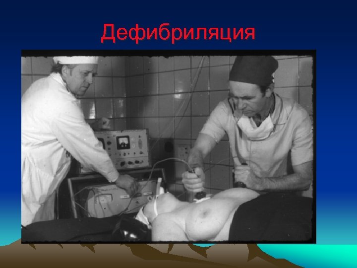 Дефибриляция 