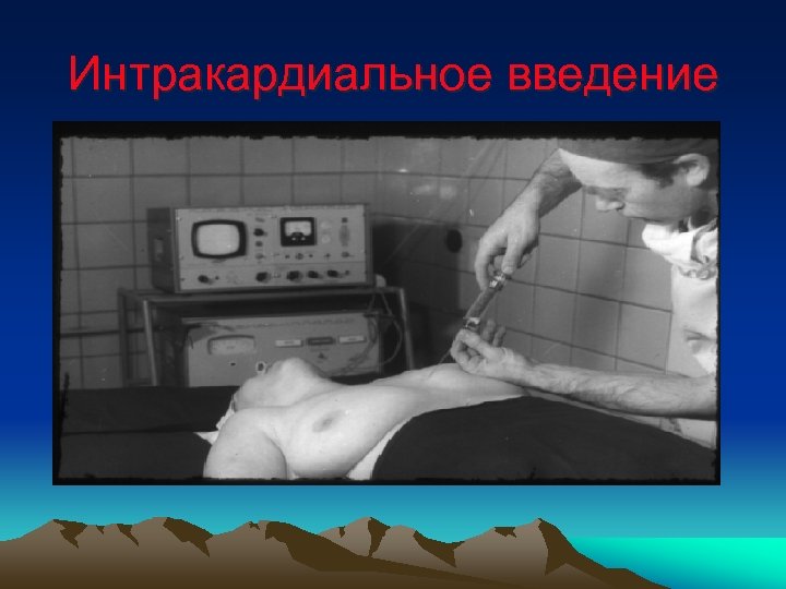 Интракардиальное введение 