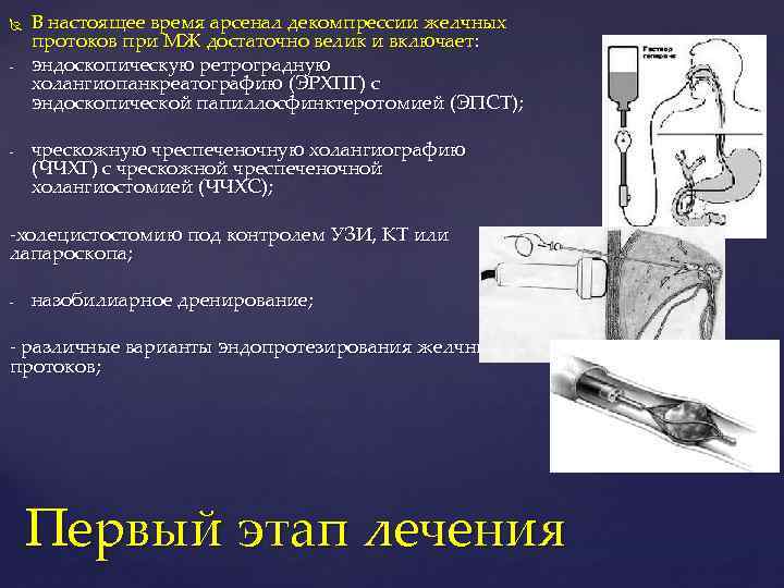 Эндоскопическая папиллосфинктеротомия презентация