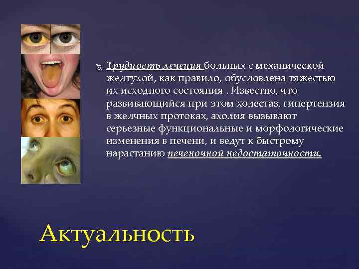  Трудность лечения больных с механической желтухой, как правило, обусловлена тяжестью их исходного состояния.