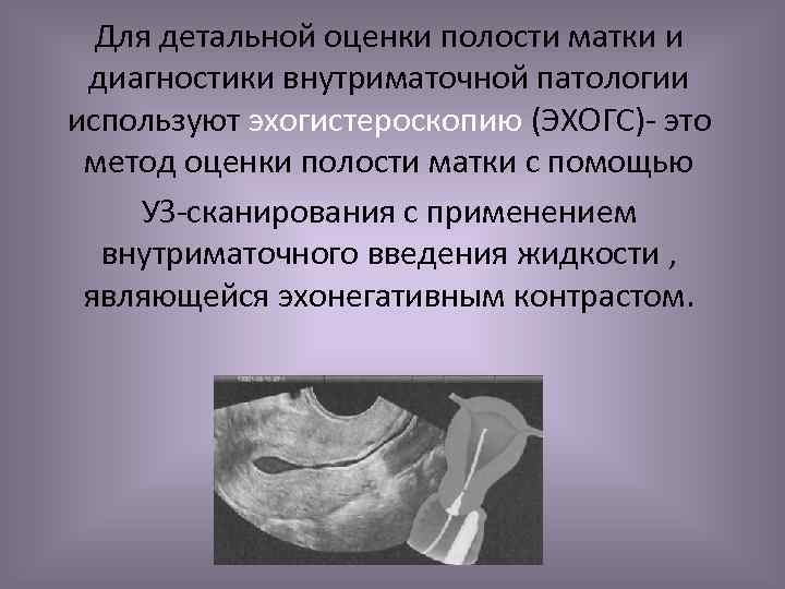 Для детальной оценки полости матки и диагностики внутриматочной патологии используют эхогистероскопию (ЭХОГС)- это метод