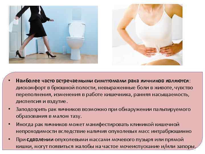  • Наиболее часто встречаемыми симптомами рака яичников являются: дискомфорт в брюшной полости, невыраженные