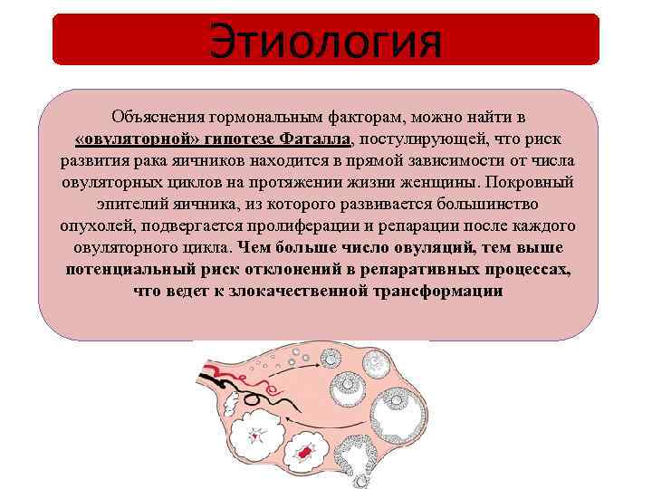 Этиология Объяснения гормональным факторам, можно найти в «овуляторной» гипотезе Фаталла, постулирующей, что риск развития