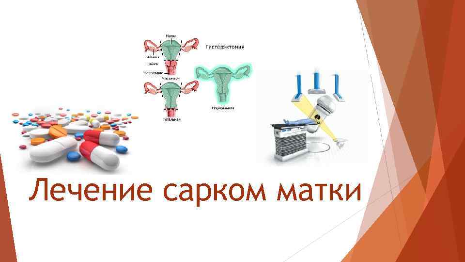 Лечение сарком матки 