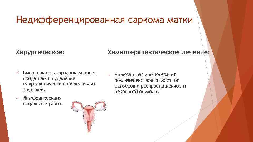 Недифференцированная саркома матки Хирургическое: P Выполняют экстирпацию матки с придатками и удаление макроскопически определяемых