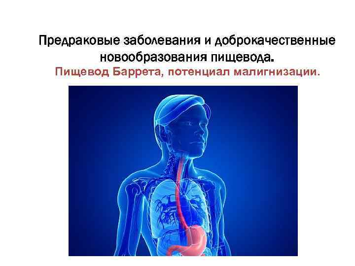 Заболевания пищевода факультетская хирургия презентация