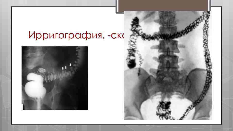 Ирригография, скопия 