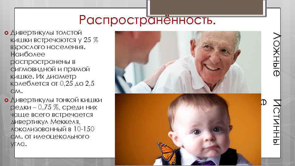 Распространённость. Ложные Истинны е Дивертикулы толстой кишки встречаются у 25 % взрослого населения. Наиболее