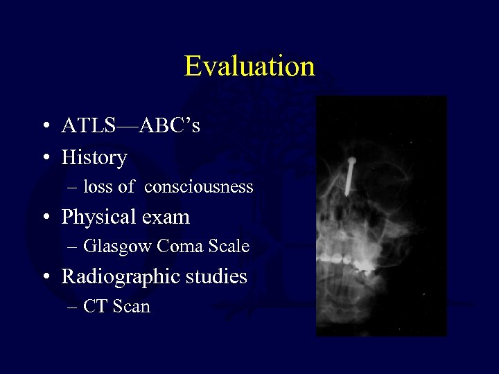 Evaluation • ATLS—ABC’s • History – loss of consciousness • Physical exam – Glasgow