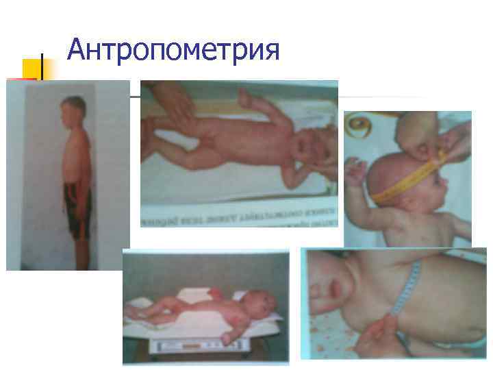 Антропометрия 