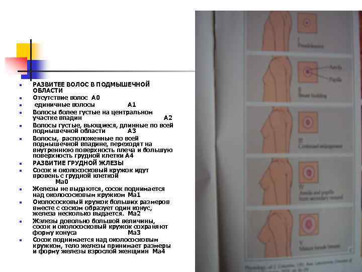  n n n РАЗВИТЕЕ ВОЛОС В ПОДМЫШЕЧНОЙ ОБЛАСТИ Отсутствие волос А 0 единичные