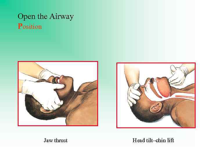 Open the Airway Position Jaw thrust Head tilt–chin lift 