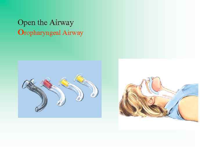 Open the Airway Oropharyngeal Airway 