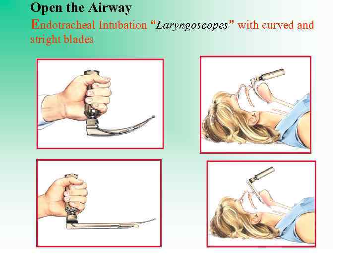 Open the Airway Endotracheal Intubation “Laryngoscopes” with curved and stright blades 