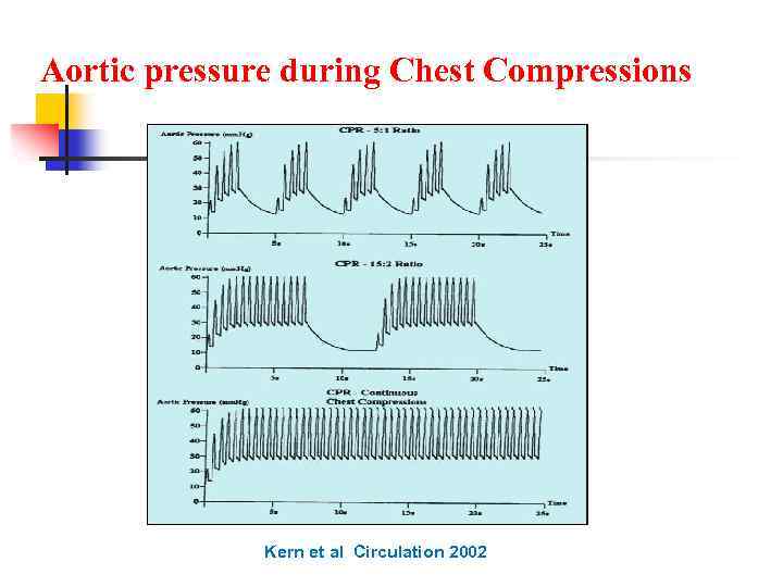 Aortic pressure during Chest Compressions Kern et al Circulation 2002 