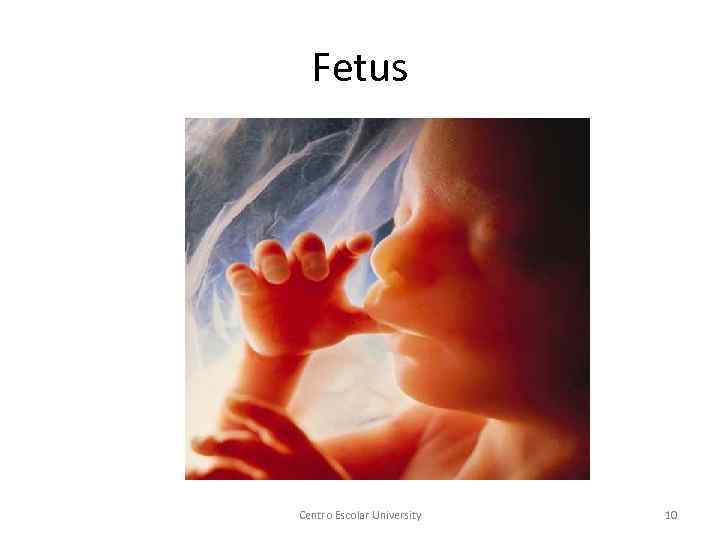Fetus Centro Escolar University 10 