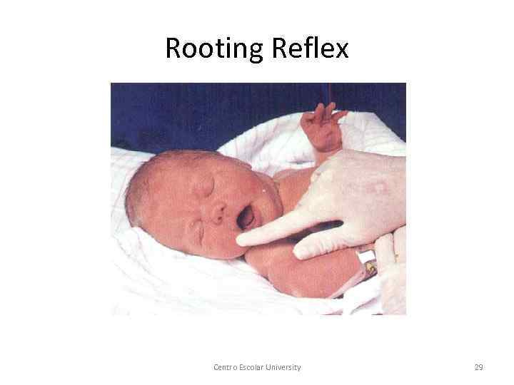 Rooting Reflex Centro Escolar University 29 